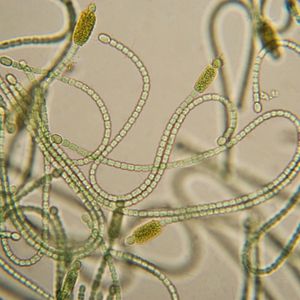 cianobacterias microoganismos